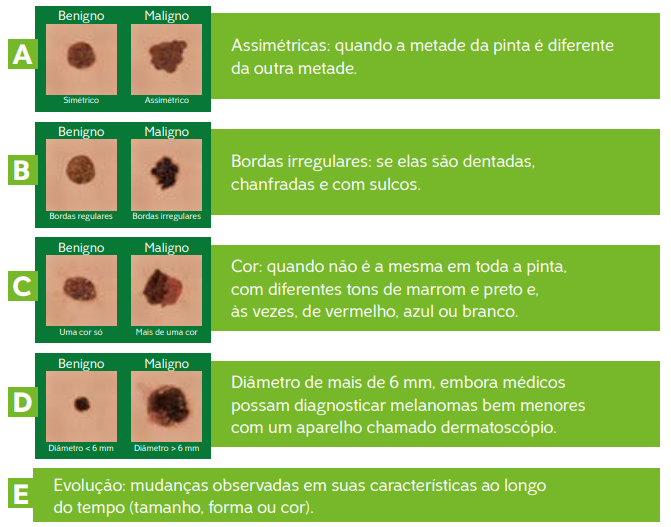 Entenda A Diferença Entre Os Tipos De Câncer De Pele