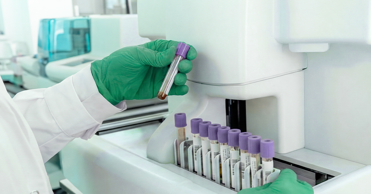 Exame para detecção de doença residual