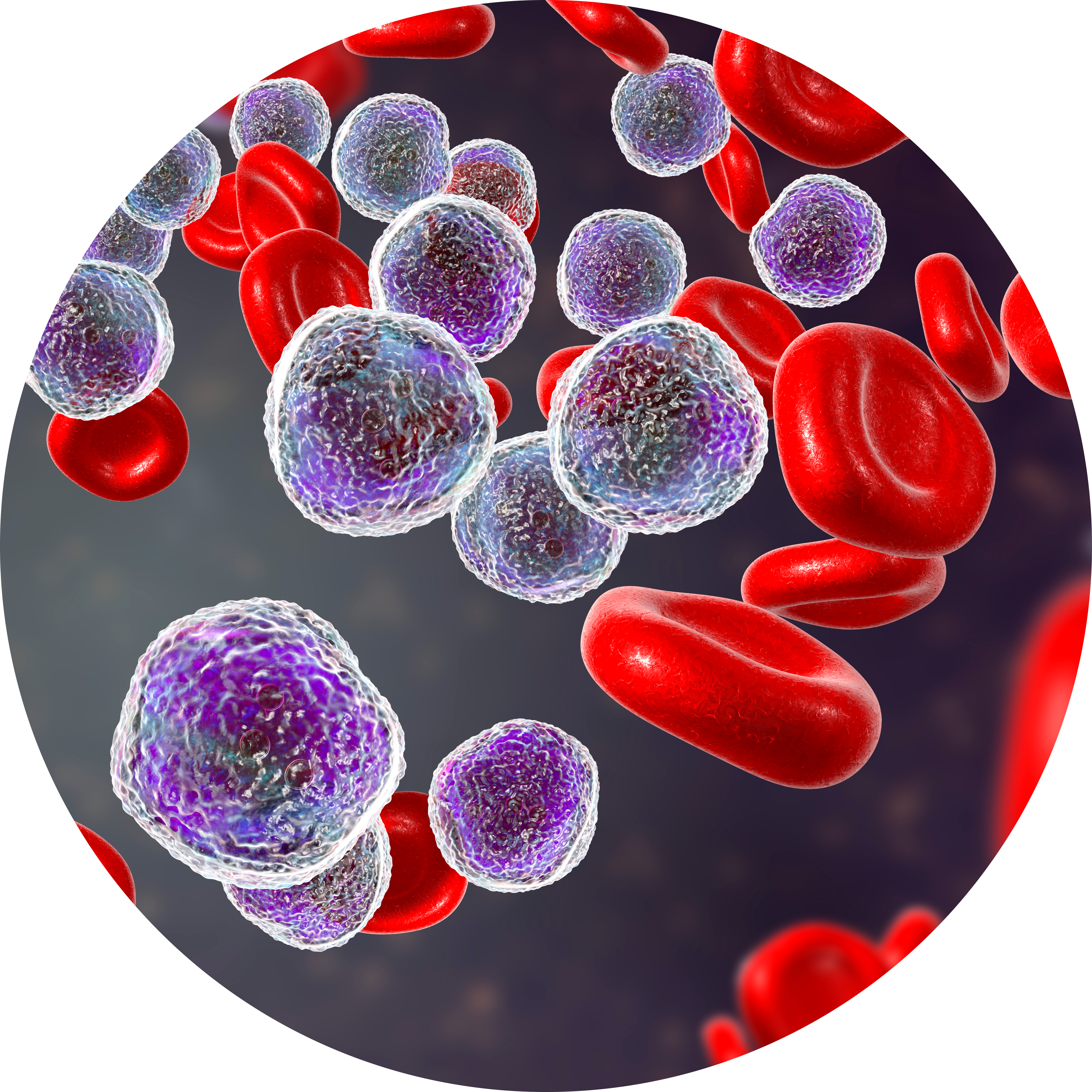 Leucemia