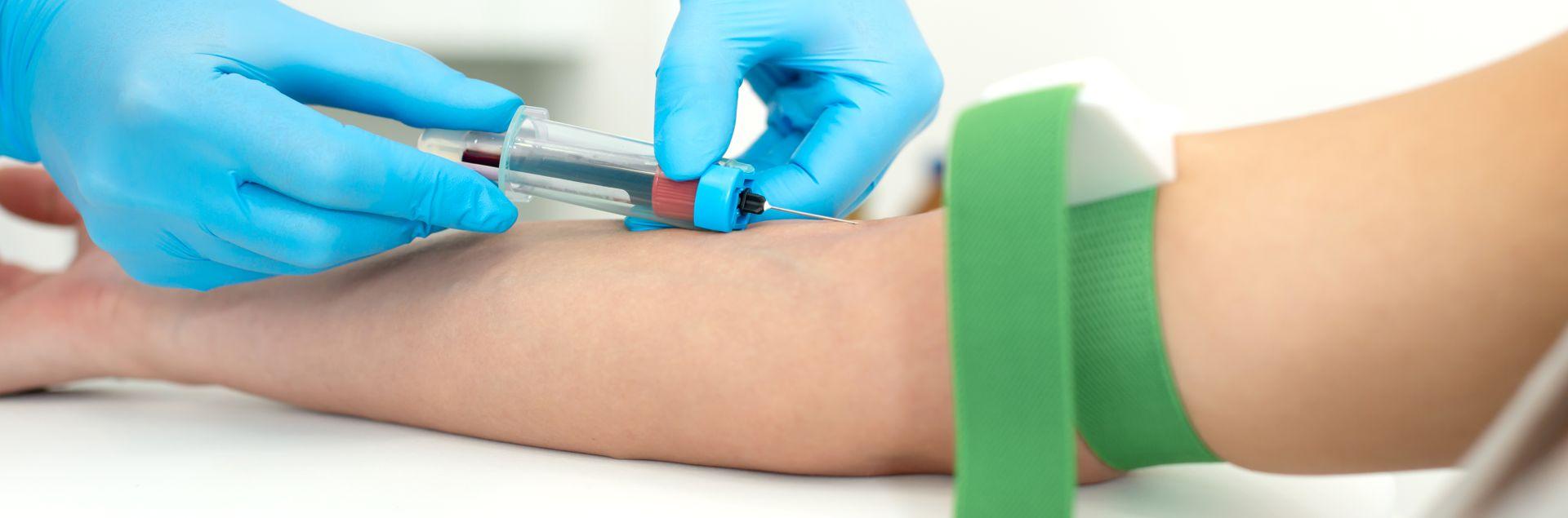 Uma coleta de exame de sangue com um acesso a vácuo