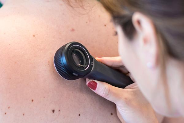Doutora examina pinta nas costas desnudas de uma mulher branca 
