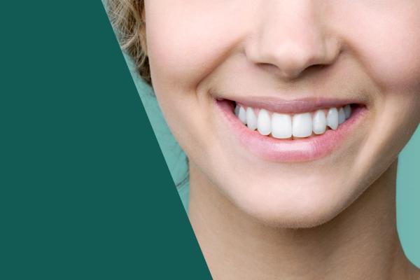 Rosto de uma mulher jovem, loira e branca com dentes muito brancos