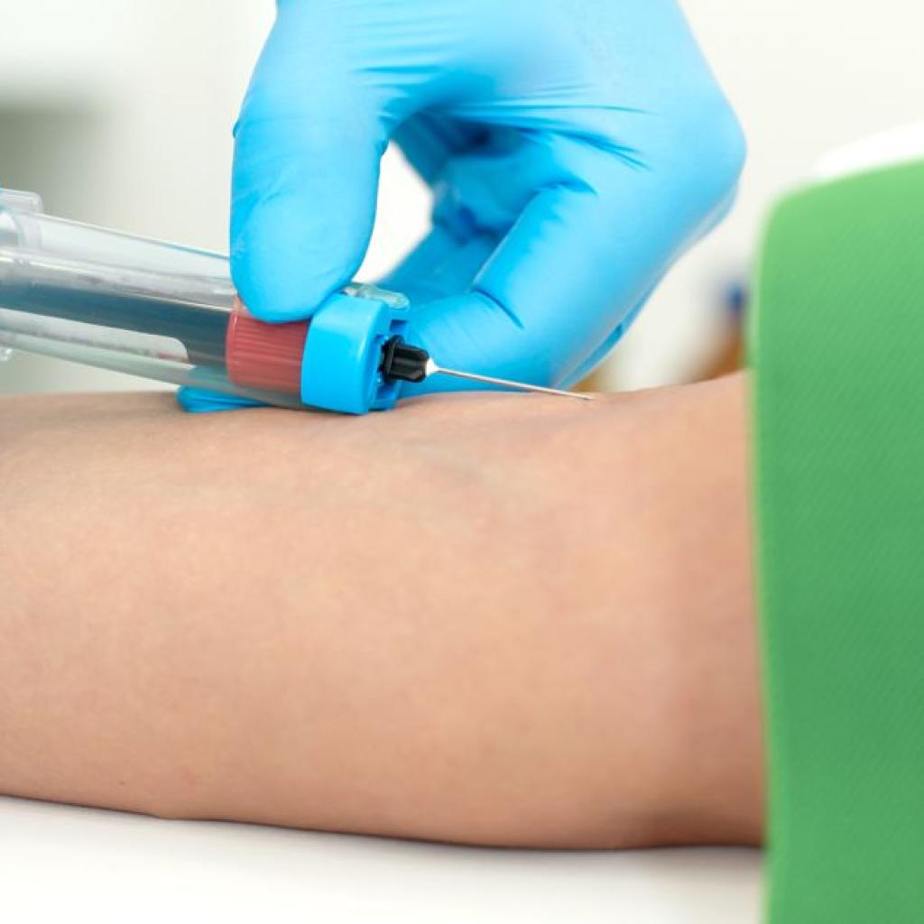 Uma coleta de exame de sangue com um acesso a vácuo