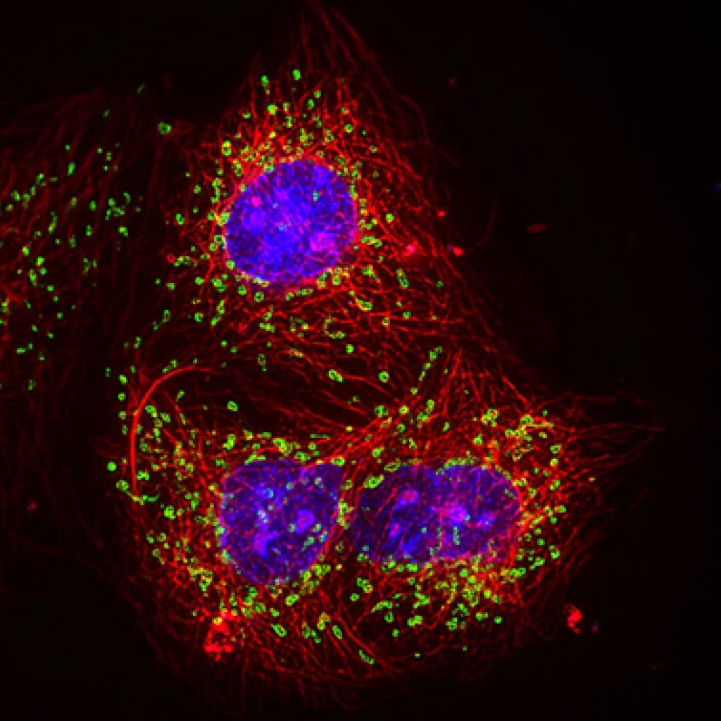 Exemplo do resultado das imagens no equipamento. Células em destaque lilás e vermelho