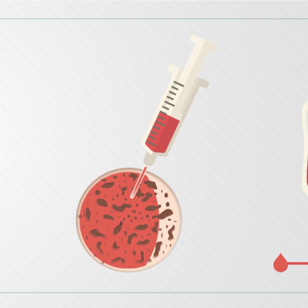 Ilustração com fundo branco e uma bolsa de sangue vermelha, além de uma seringa espetada numa célula vermelha