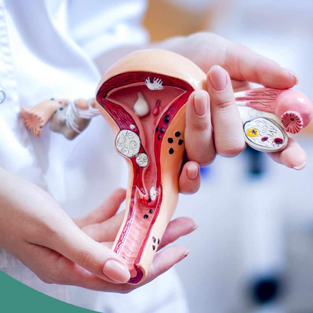 Mãos brancas de uma médica segurando um útero feito para aulas de medicina