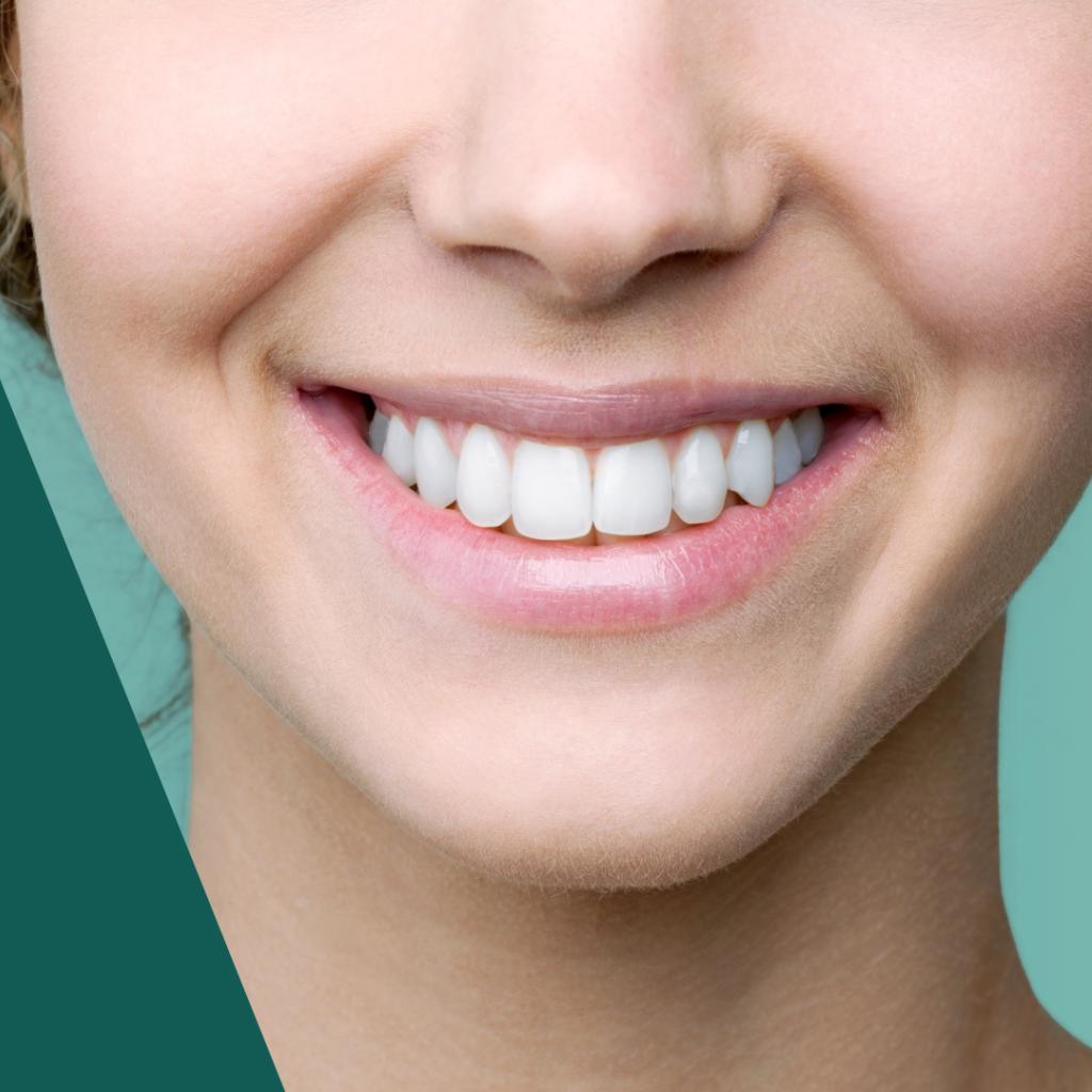 Rosto de uma mulher jovem, loira e branca com dentes muito brancos