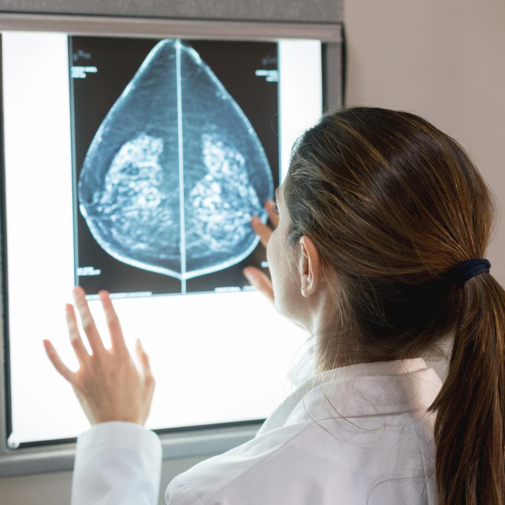 Mulher olhando a mamografia de uma paciente